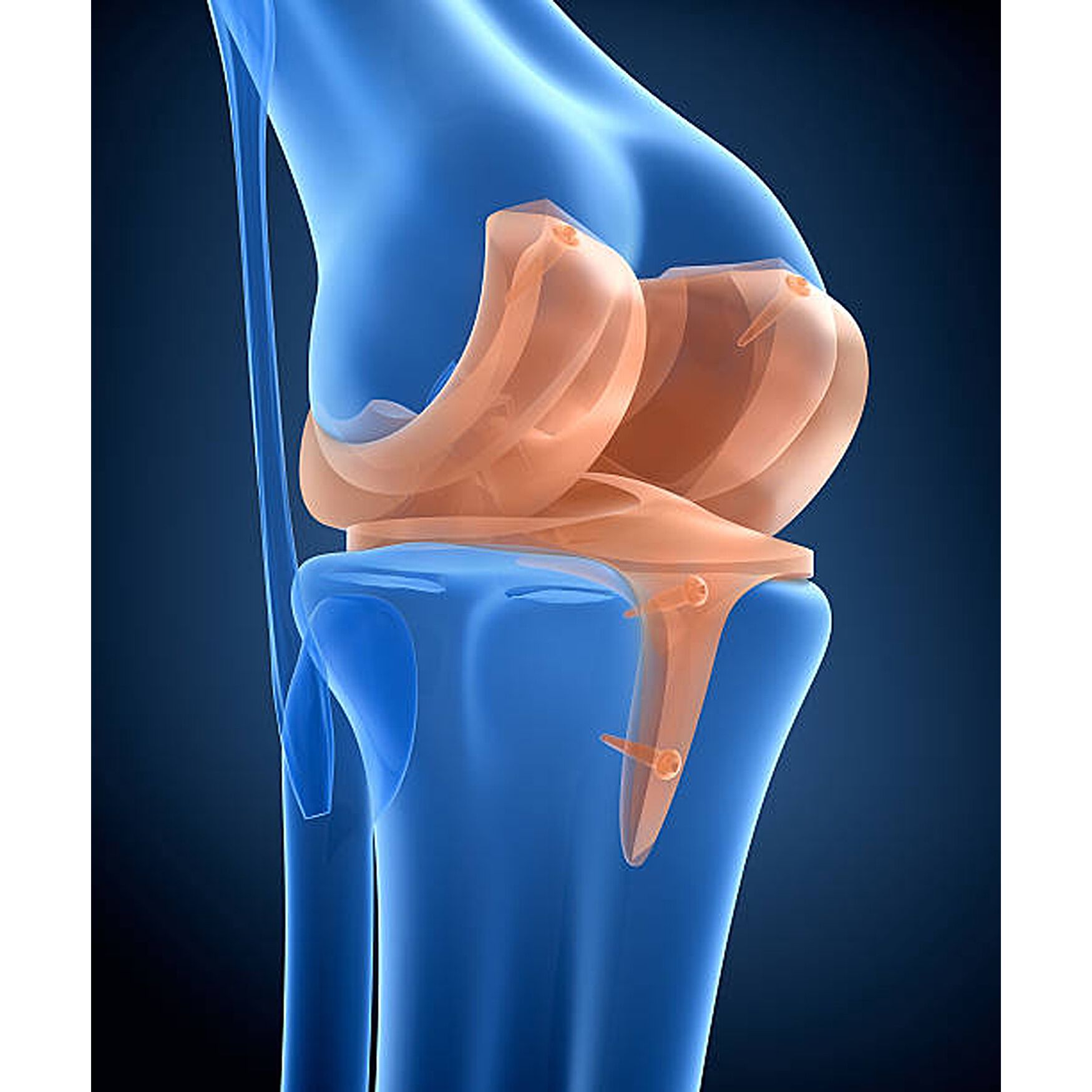 Titanium Full Leg & Knee Support Wellness, , alternate image number 4