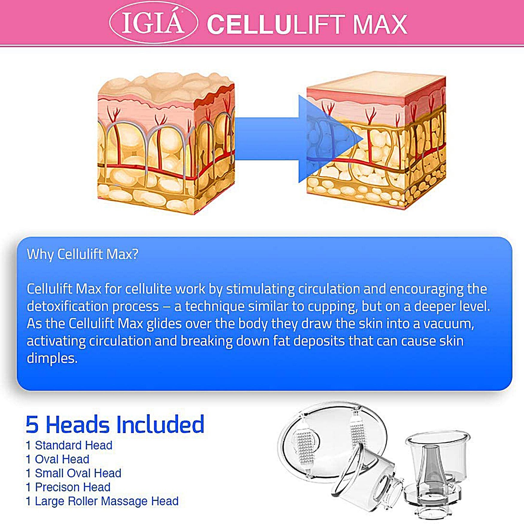 Cellulift Max Cellulite Reducing Suction Vacuum Massager Beauty Tools, , alternate image number 4