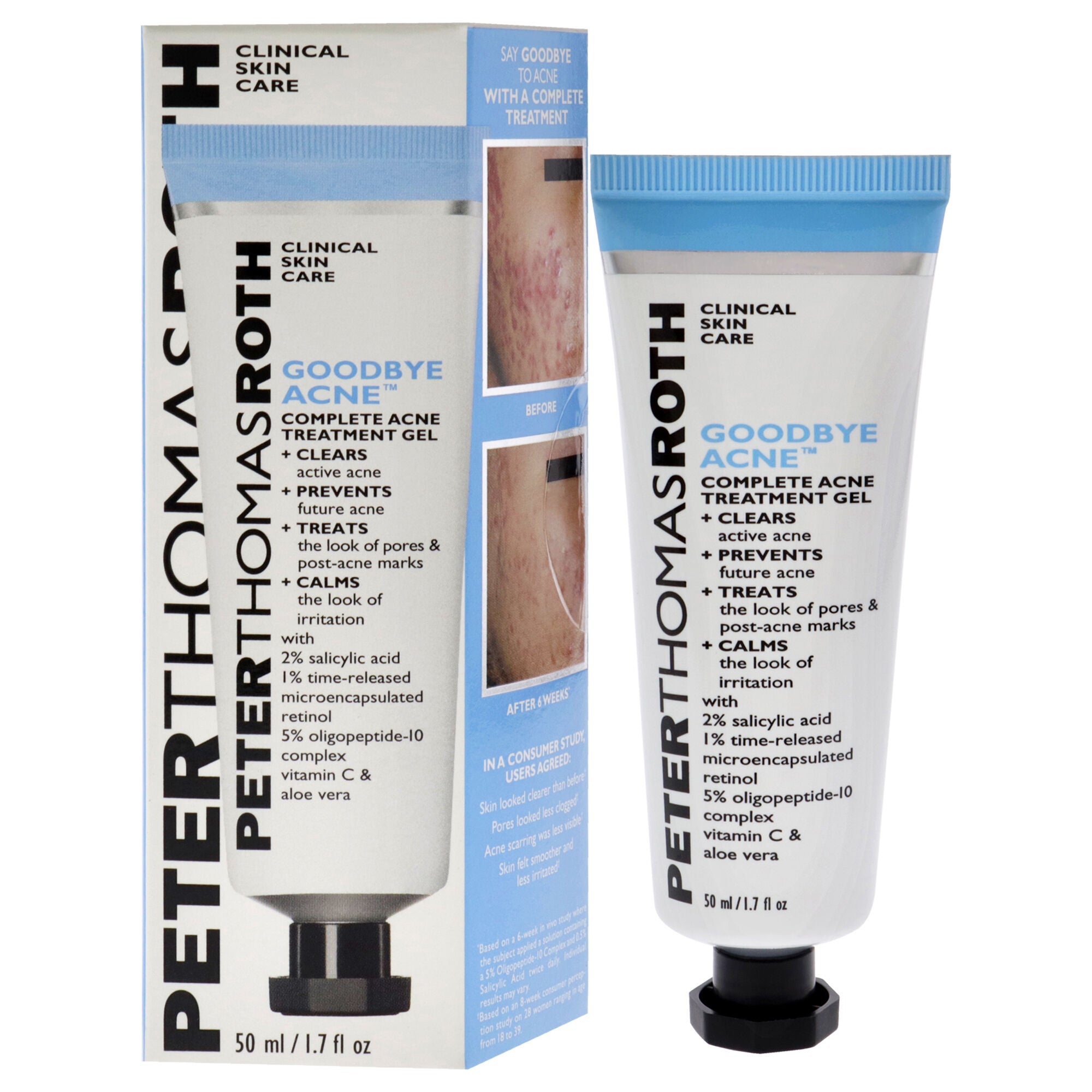 Good Bye Acne Complete Treatment Gel by Peter Thomas Roth for Unisex - 1.7 oz Treatment, See Description, hi-res image number 0